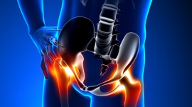 Zwyrodnienie stawu biodrowego – bolesna choroba, która długo pozostaje w ukryciu Zdrowie, BIZNES - Na początku boli tylko sporadycznie – zwykle po wzmożonym wysiłku fizycznym. Z czasem jednak ból towarzyszy już niemal każdej chwili życia – w dzień i w nocy.