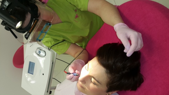 Innowacje medyczne. Veinwave w białostockiej klinice Estimed LIFESTYLE, Uroda - Likwidacja nawet najmniejszych „pajączków” bez ryzyka powstania blizn i przebarwień, a przy tym bezboleśnie. To niektóre zalety leczenia nowatorską metody Veinwave.