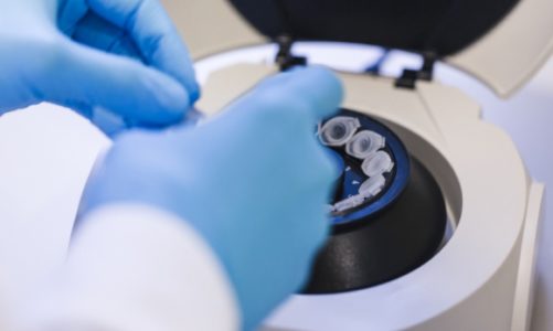 Chroń się przed grypą, czyli Twoja odporność zapisana w DNA