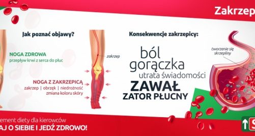 Choroby zawodowe kierowców. Jak się przed nimi ustrzec