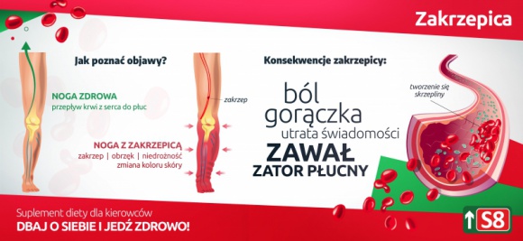 Choroby zawodowe kierowców. Jak się przed nimi ustrzec