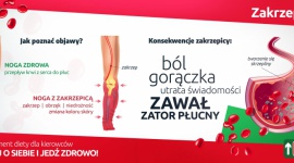 Choroby zawodowe kierowców. Jak się przed nimi ustrzec Zdrowie, BIZNES - Kierowcy spędzają w trasie od kilku dni nawet do kilku tygodni. Taki tryb pracy naraża tę grupę zawodową na wiele chorób.