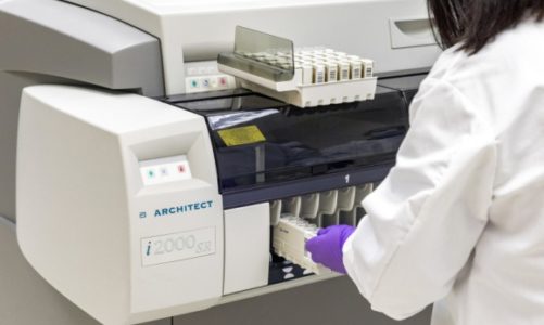 Testy na przeciwciała COVID-19 z certyfikatem CE IVD firmy Abbott już w Polsce