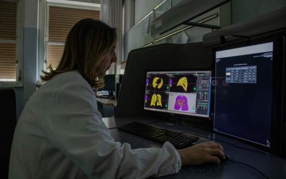Synapse 3D ułatwia zarządzanie diagnostyką pacjentów podczas pandemii COVID19