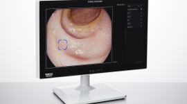 Sztuczna inteligencja wspiera leczenie raka jelita grubego Zdrowie, BIZNES - PENTAX MEDICAL DISCOVERY™, rozwiązanie wspierające walkę z rakiem jelita grubego, teraz dostępne także w Europie, Afryce i na Bliskim Wschodzie oraz na niektórych rynkach regionu Azji i Pacyfiku.