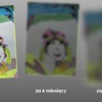 Zaćma – czym jest i do czego prowadzi nieleczona?